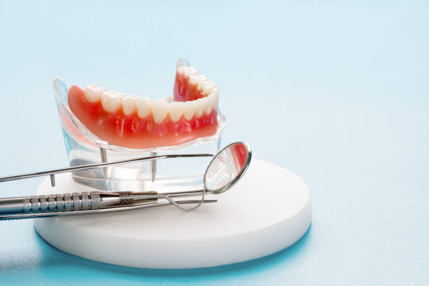 Dental Bonding in Belle Chasse, LA